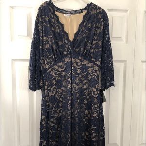 Scalloped Lace Dress